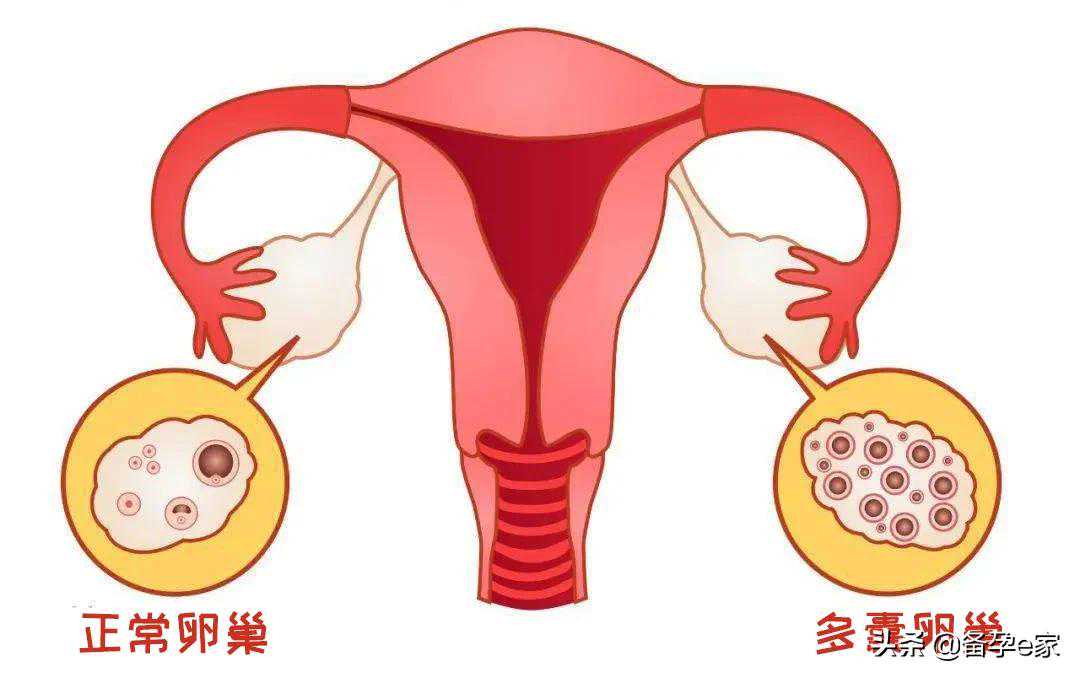 香港验血 男翻女,备孕期间排卵试纸没测到强阳就转弱了能受孕吗这是怎么回事
