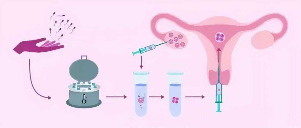 去香港验血价格多少,你要了解的几种辅助生殖的助孕方式