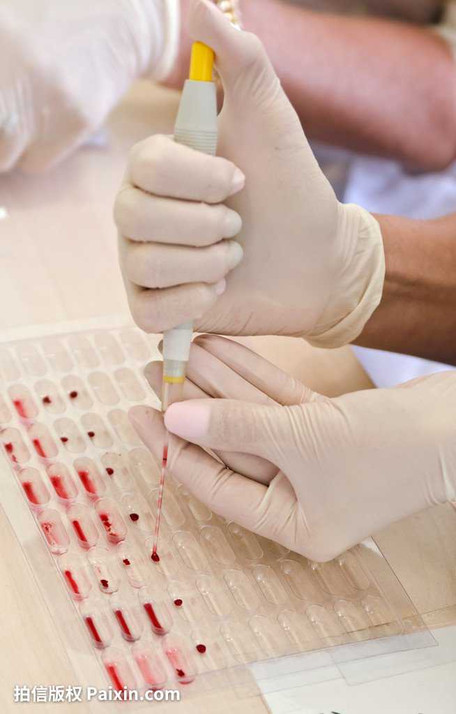 香港验血胎儿性别价格_dna验血测男女多少钱,验血两次成果不同是真的吗